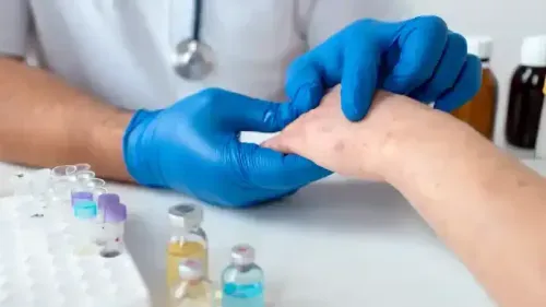 Vitamin D and Pemphigus - A Critical Connection
